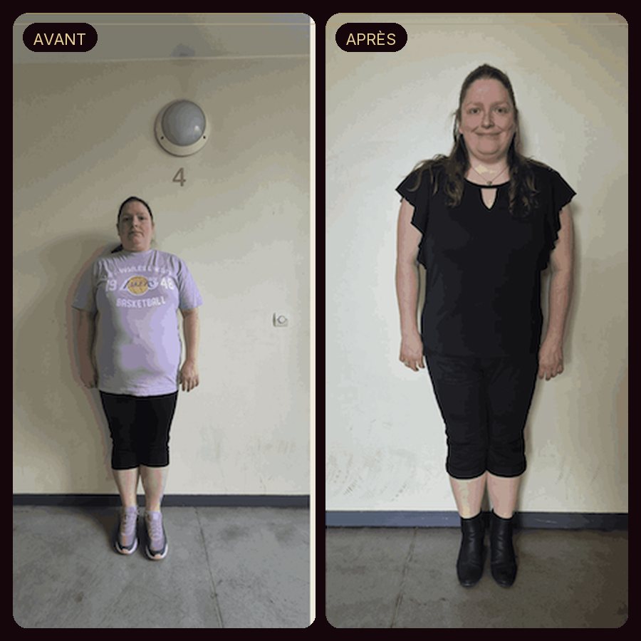 Avant / après — Aurélie K., 38 ans